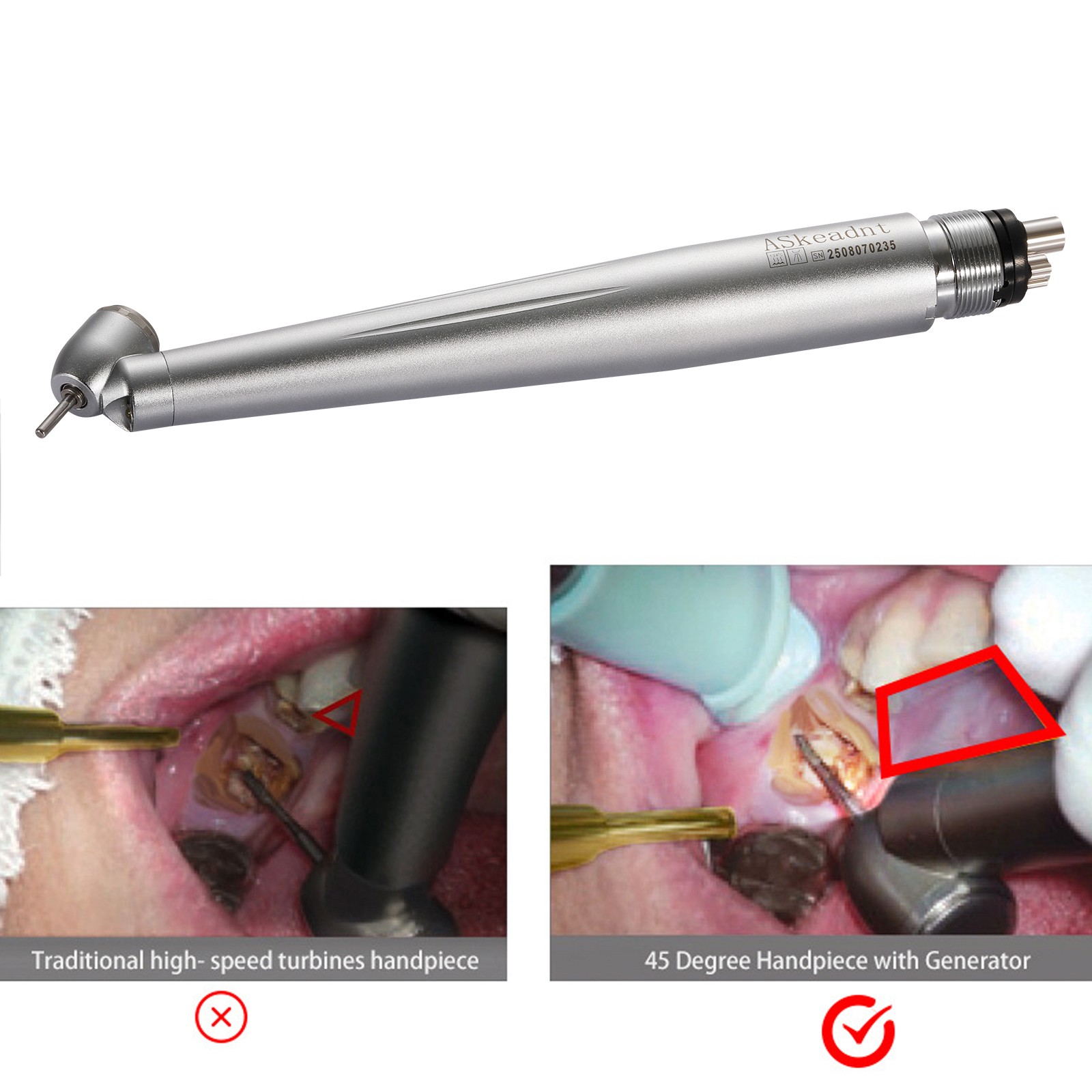 Dental LED Curing Light Lamp Wireless Cordless Resin Cure Lamp 5W 2000MW USPS