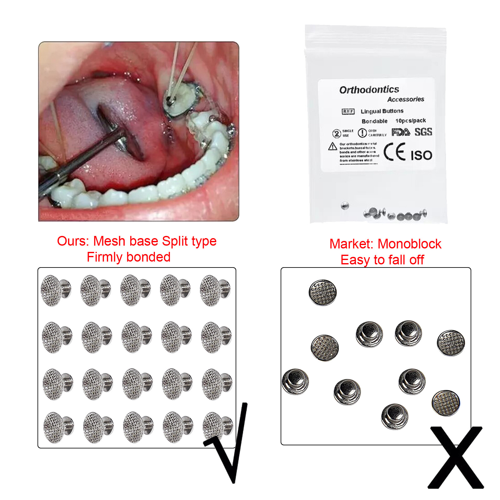 27 Options Dental Orthodontic Bondable Lingual Buttons Round/Rectangular Base