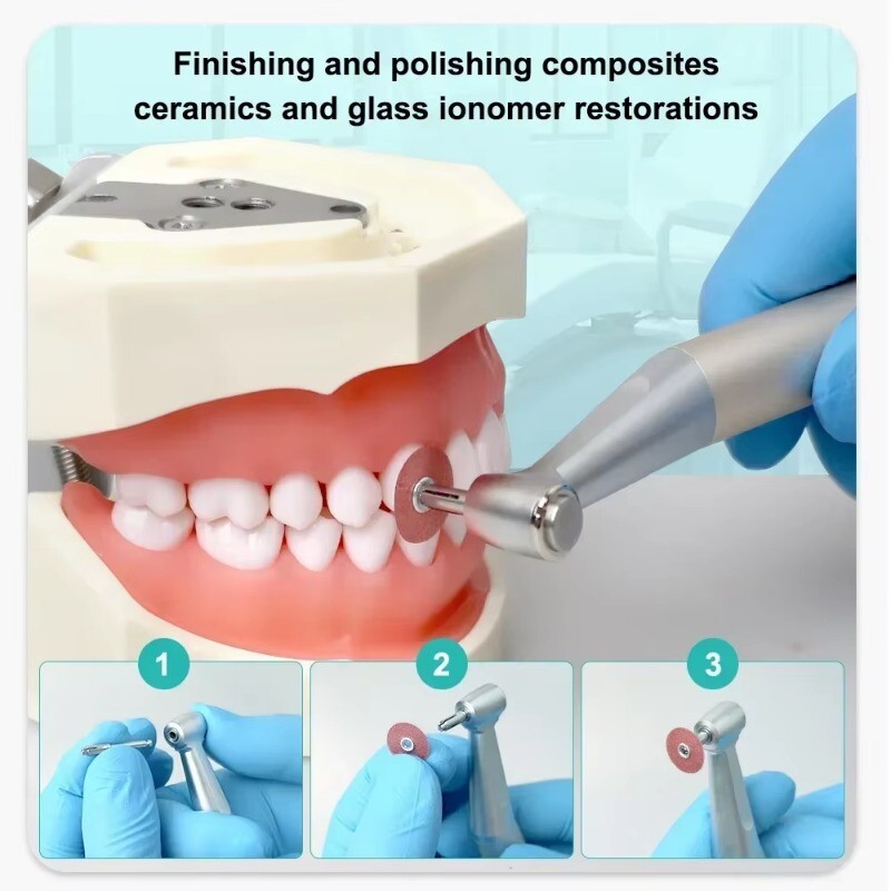 Dental Soflex Coarse Medium Superfine Fine Composite Finishing Polishing Discs