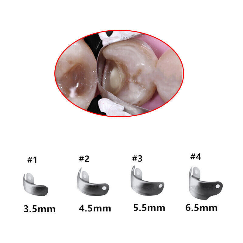 50 Pcs Dental Matrix Bands Palodent V3 Style Sectional Contoured Matrices Refill