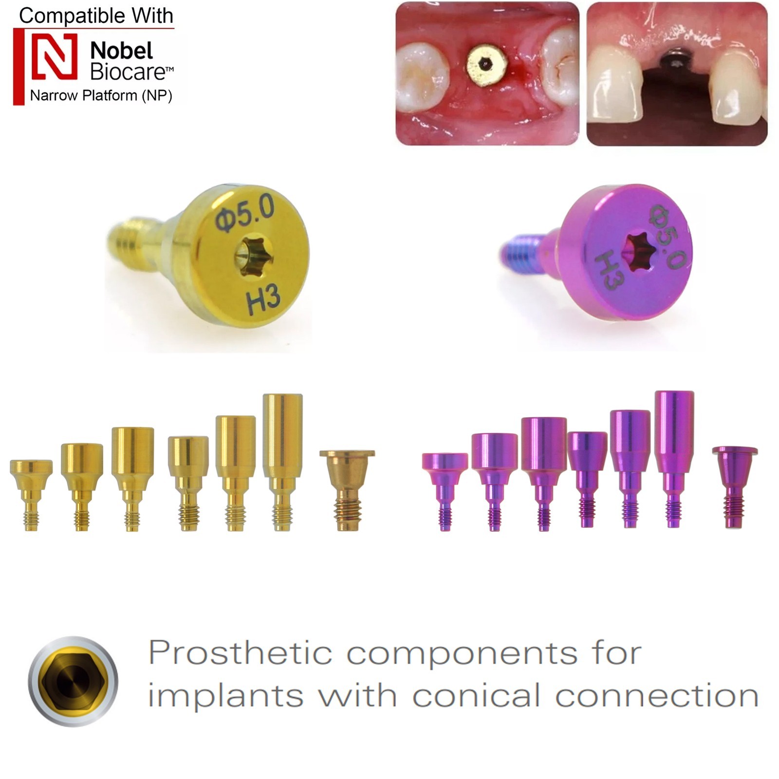 US Nobel Active Nobel Parallel CC Healing Abutment Compatible Conical Connection