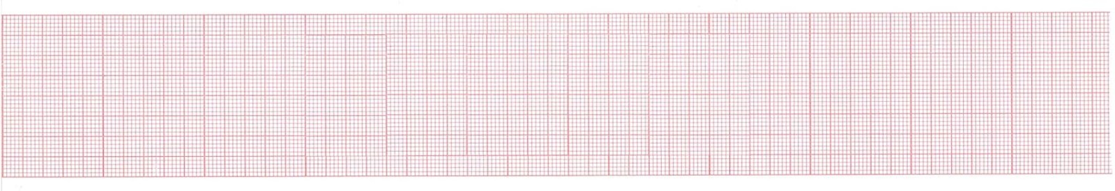 Contec 80A ECG Chart Paper, 50mm X 20m – 10 Rolls