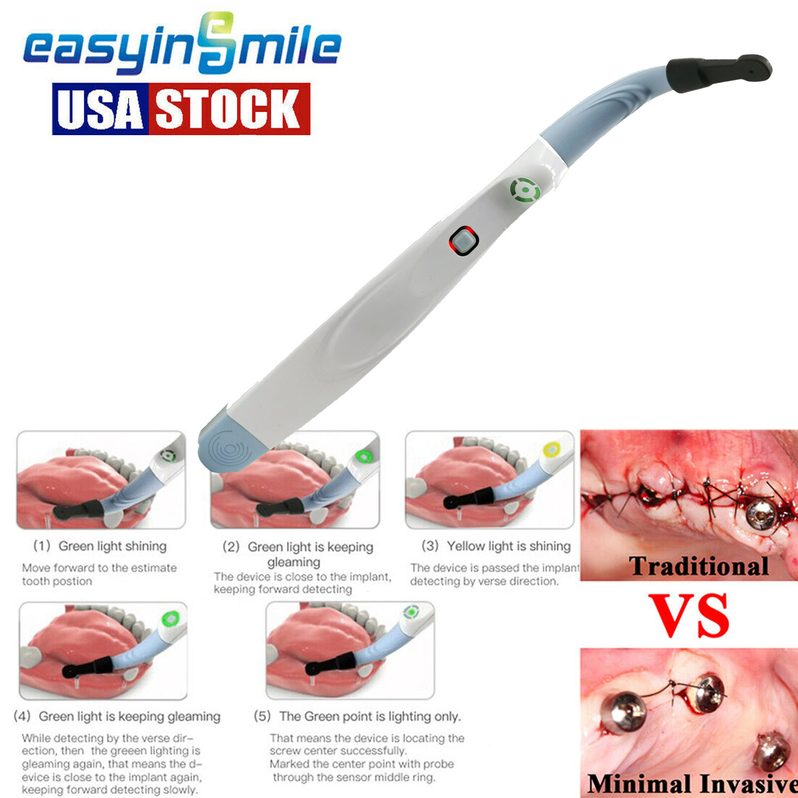Dental Implant Detector Locator Surgical Abutment Finder 270° Spotting Sensor