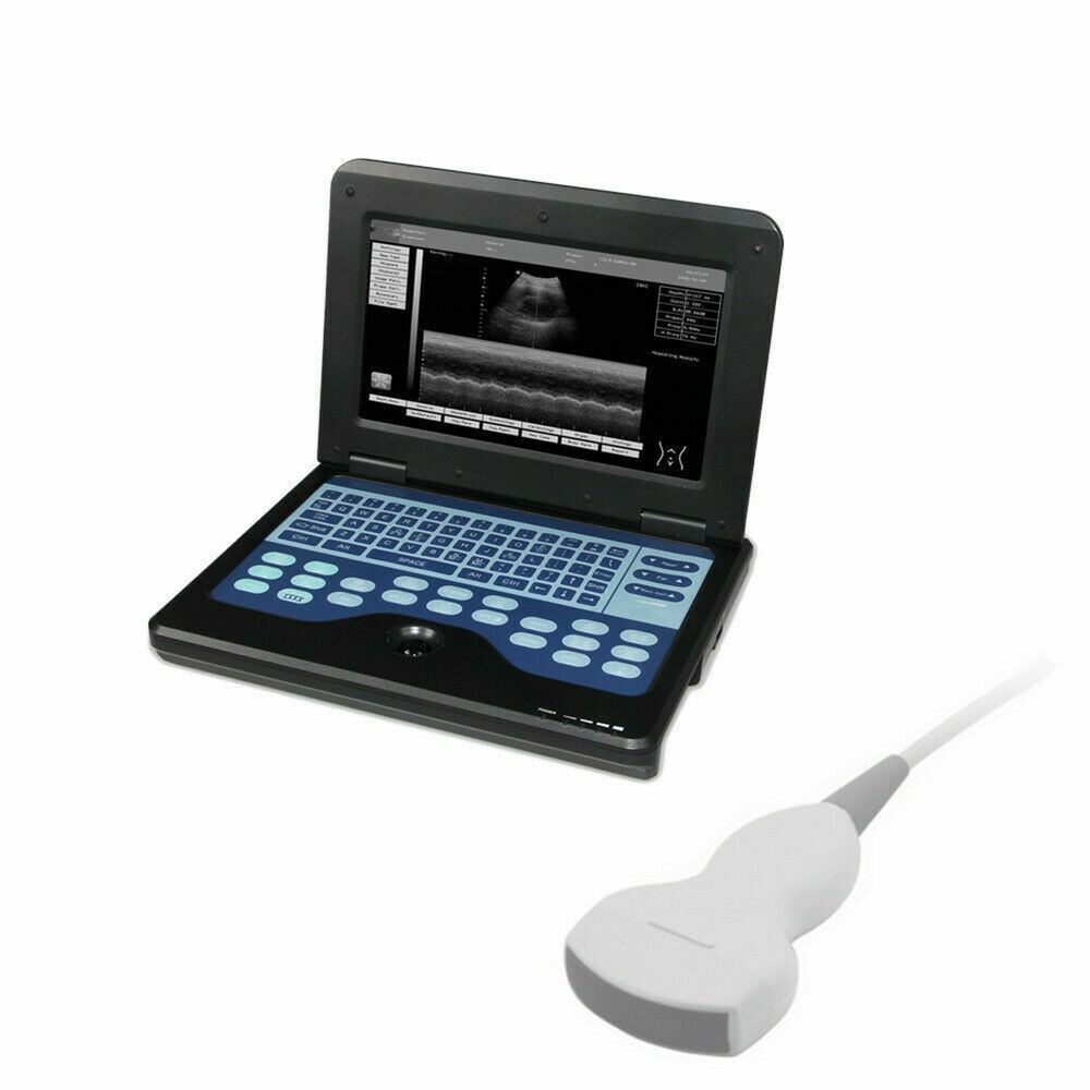 New Portable Ultrasound Scanner Machine Diagnostic System escáner de ultrasonido