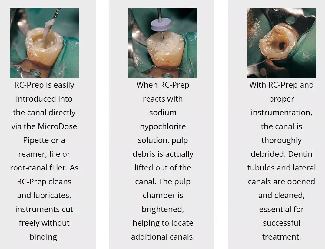 Premier RC-Prep Chemo-Mechanical Preparation of Root Canals, (18 Gm Jar)