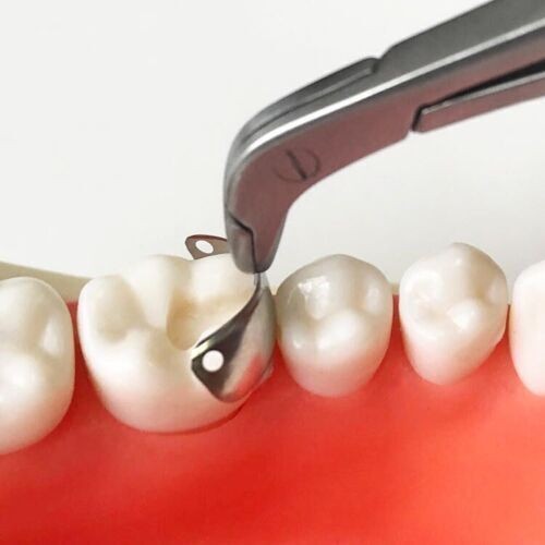 Dental Fit Garrison Palodent System Matrix Bands Ring Sectional Matrice Clamp
