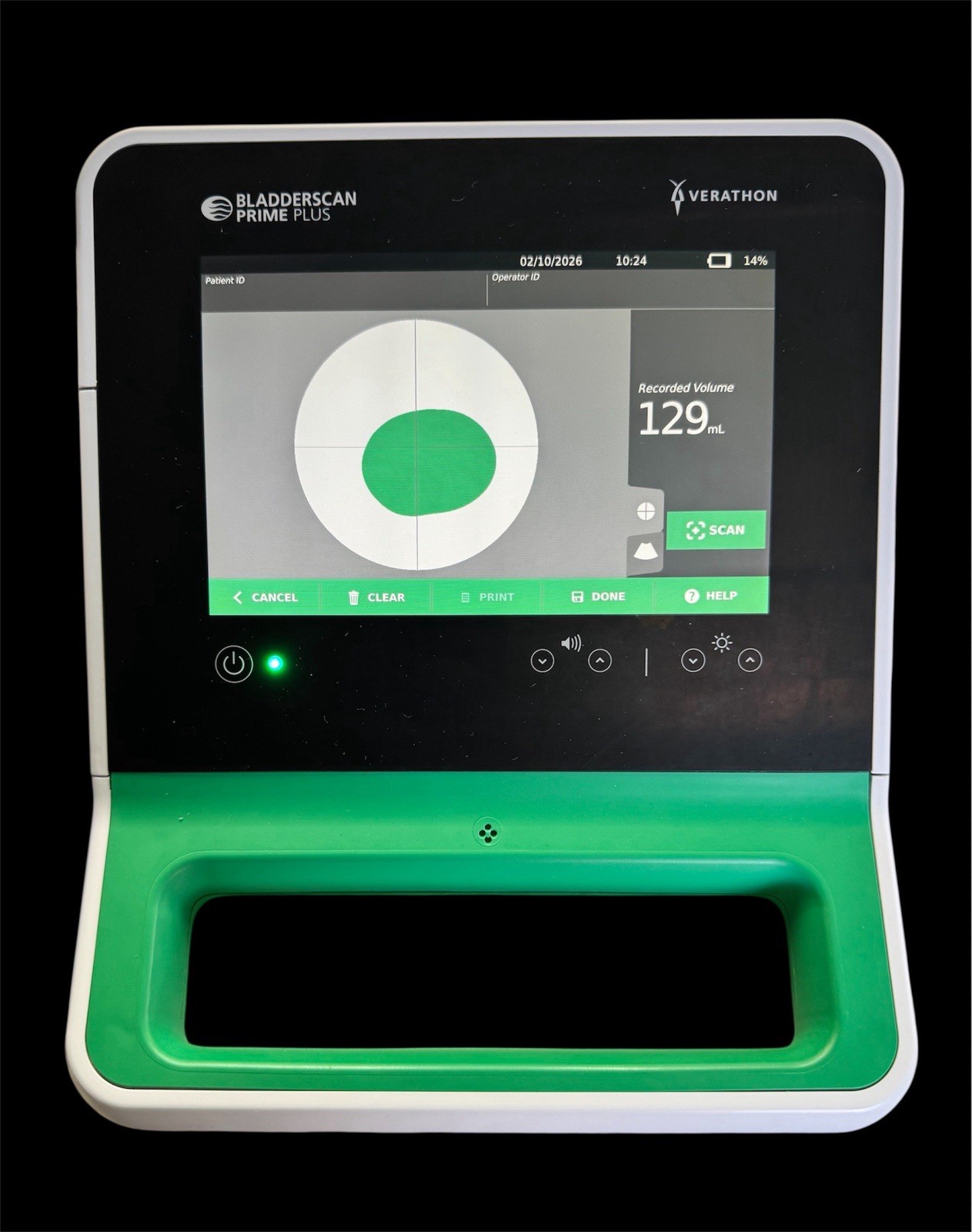 CERTIFIED REMANUFACTURED VERATHON PRIME PLUS BLADDER SCANNER 1 YEAR WARRANTY