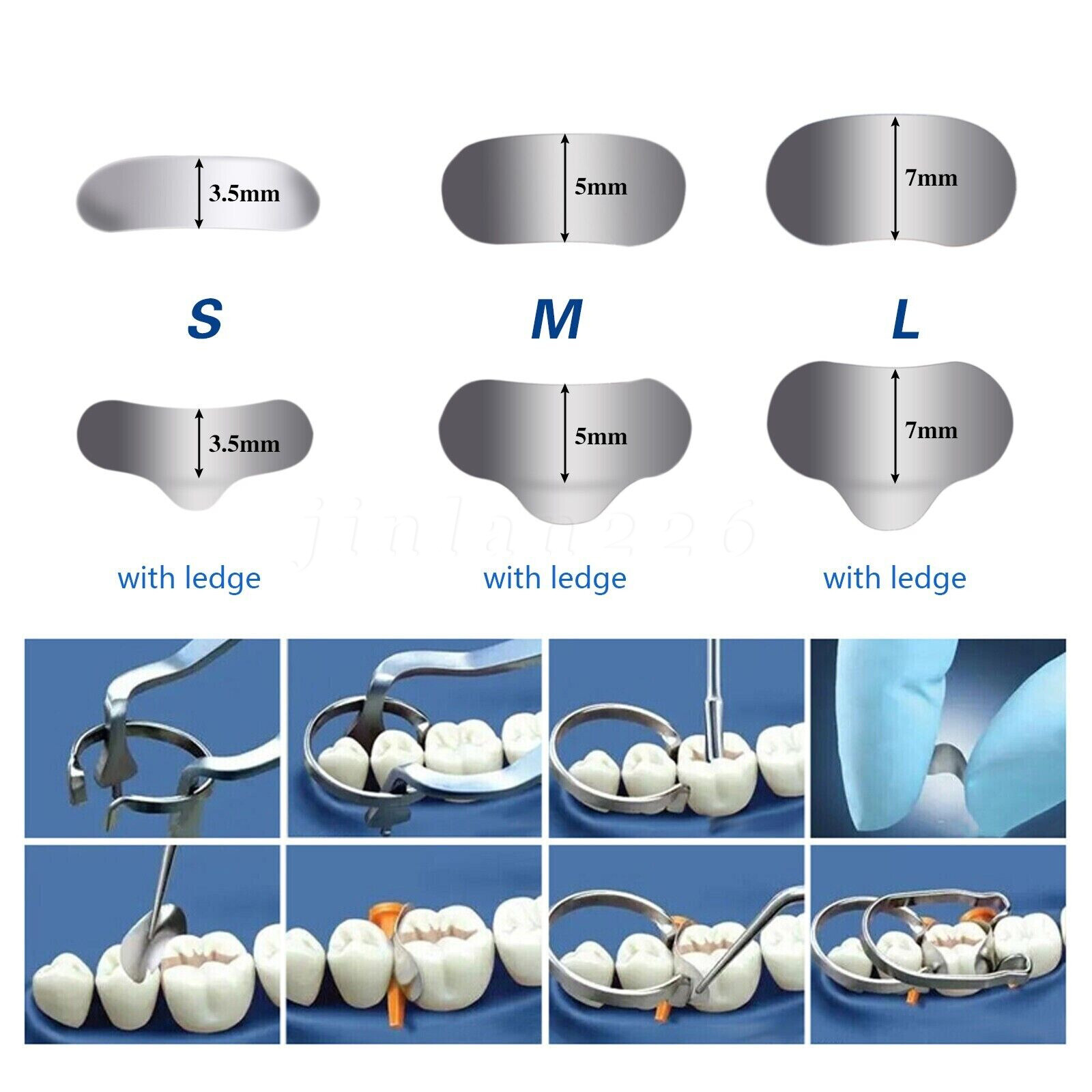 50 Pcs Dental Metal Matrices Matrix Band Sectional Contoured Refill S/M/L 35μm
