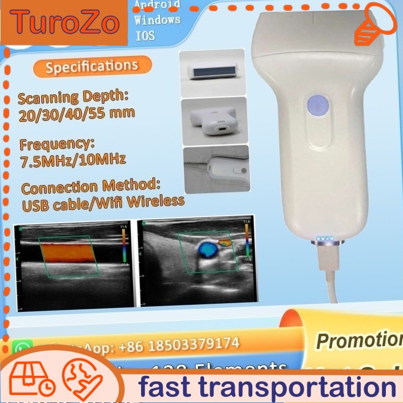 7.5MHz/10.0MHz Handheld Wireless Ultrasonic Linear 128 Element Color Doppler