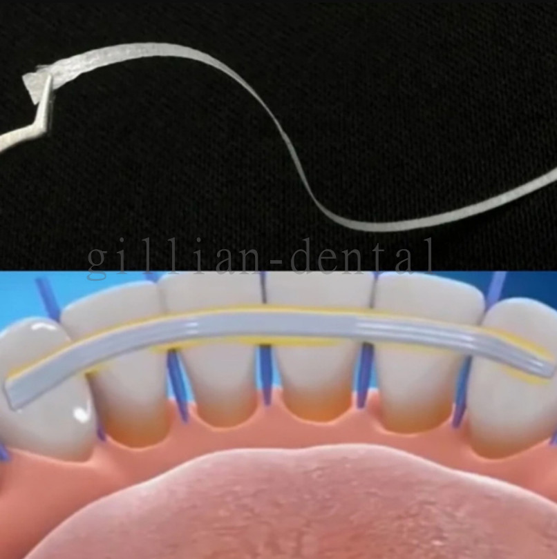 1* Dental Flexible Fiber Strip Glass Splint Retainer Loose Tooth Fixation Strips